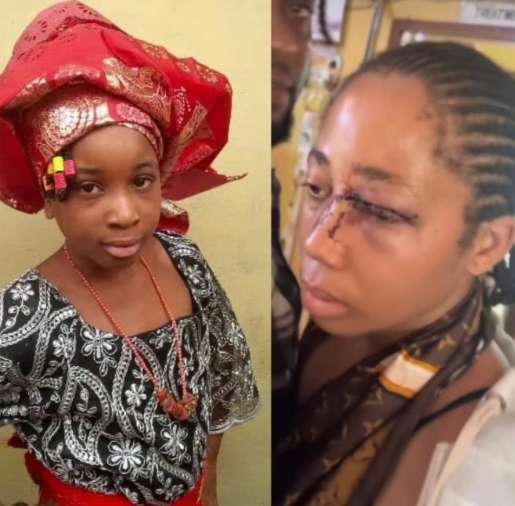 Fresh Update Emerges in Case of 18-Year-Old Allegedly Abused by Husband