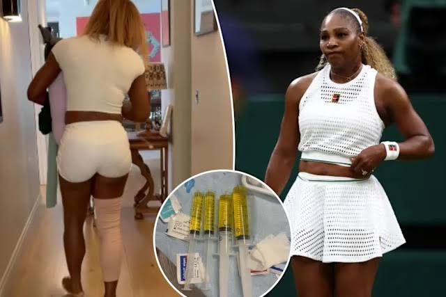 Serena Williams Withdraws from Wimbledon Doubles Match with Sister Venus Due to Knee Injury
