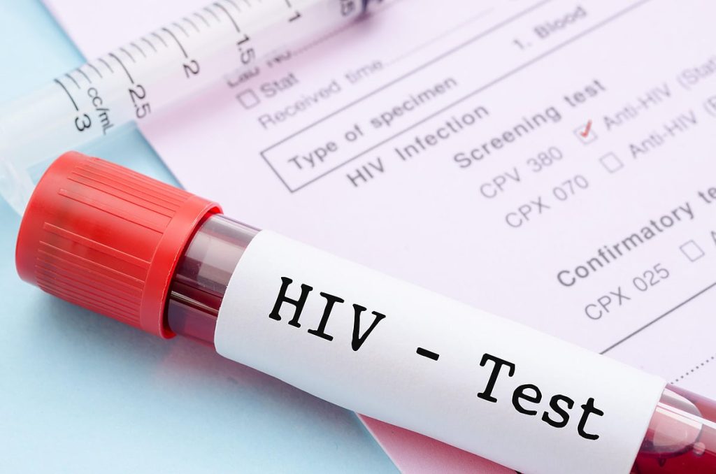 Lagos Clarifies HIV Figures, Says Reported Cases Are Diagnoses, Not New Infections